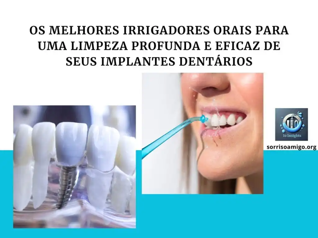 top 5 melhores irrigadores orais para implantes
